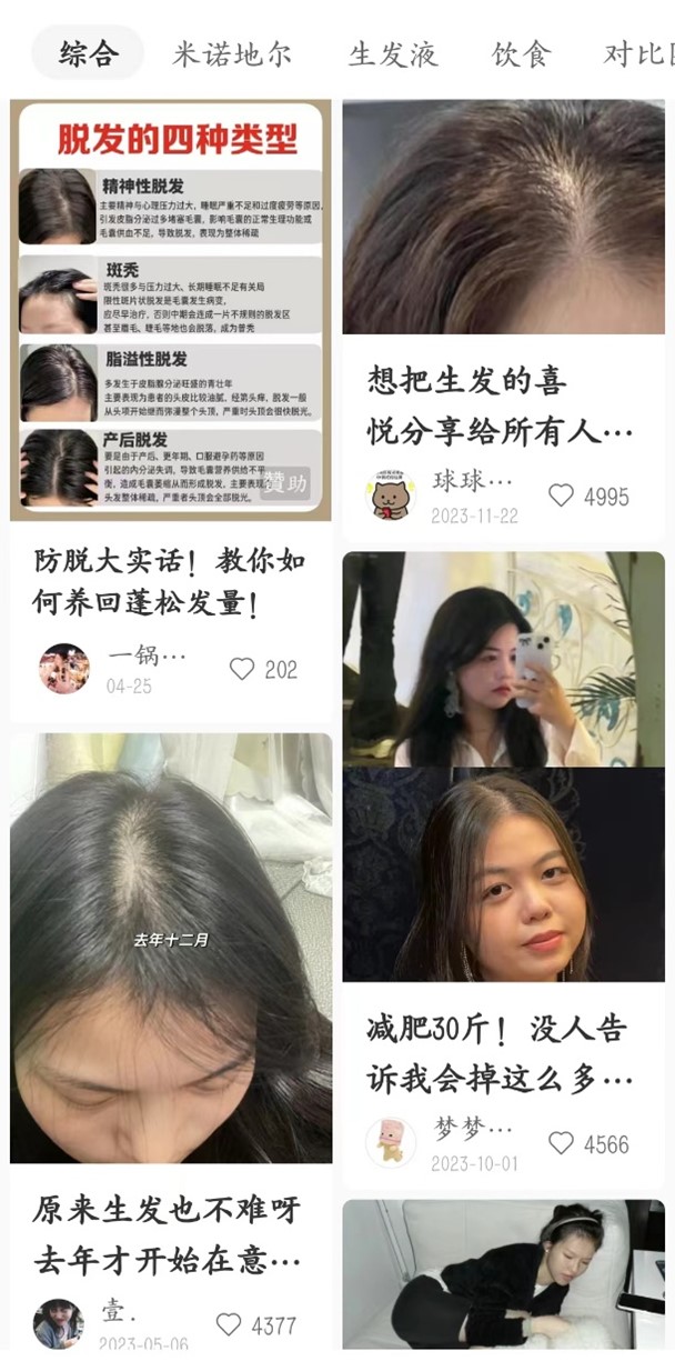 Hair growth concerns on Chinese social media platforms